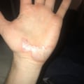 Can a pressure washer burn out?