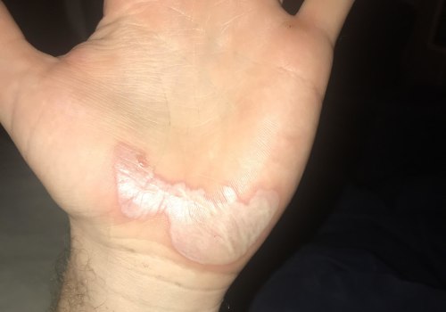 Can a pressure washer burn out?